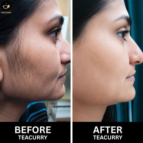 Teacurry Facial Hair Tea - Women Before and After