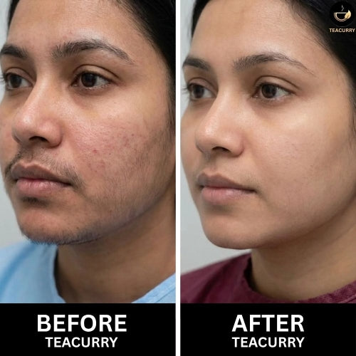 Teacurry Facial Hair Tea - Women Before & After