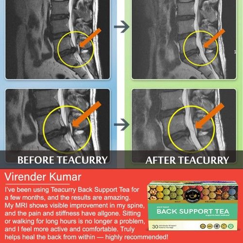 Teacurry Back Support Tea Before and After