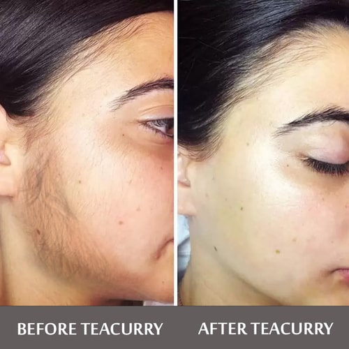 Teacurry Facial Hair Removal Tea - before and after - teacurry facial hair removal reviews
