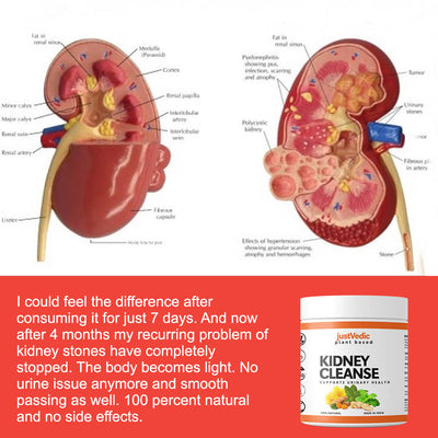 Justvedic Kidney Cleanse Drink Mix used by Customer - plant based detox powder - kidney clean powder