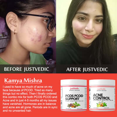 Justvedic PCOS PCOD Acne Control Drink Mix Combo used by Kamya Mishra