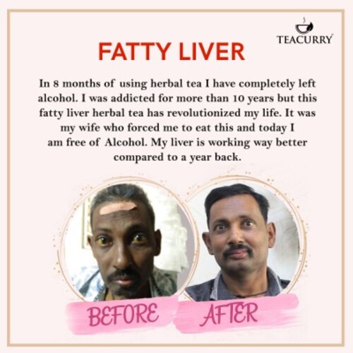 Fatty liver tea after before use