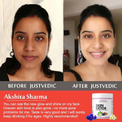 Justvedic Skin Detox Drink Mix used by Akshita Sharma